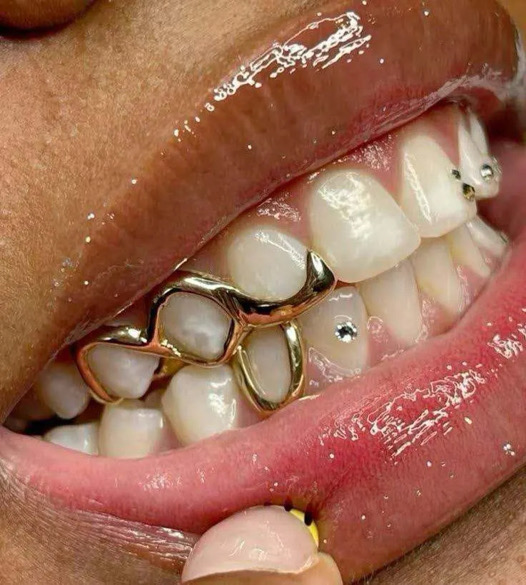 Grillz or sur mesure — design ajouré