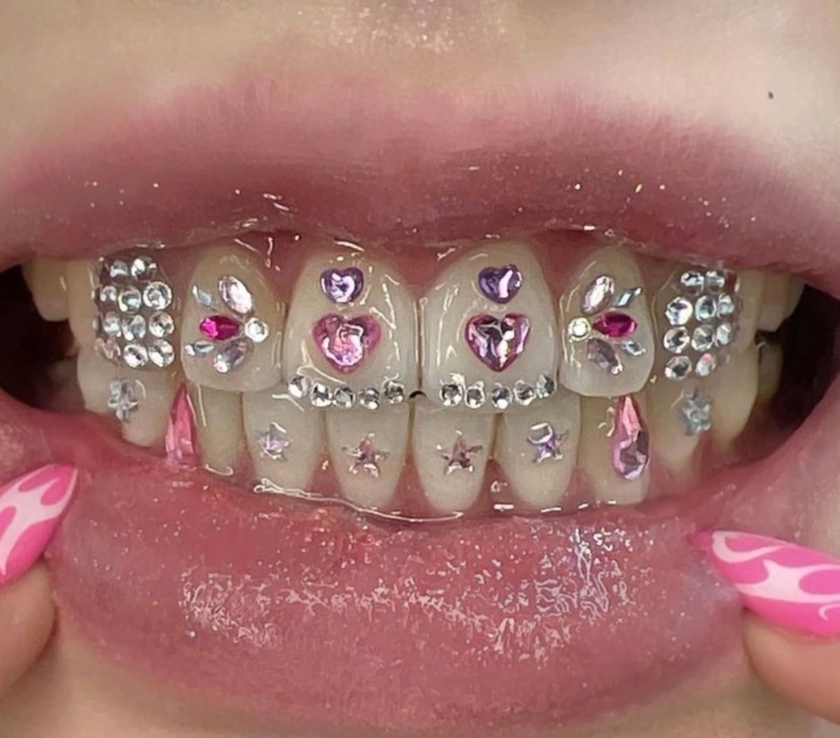 Grillz coeurs et étoiles — design féminin